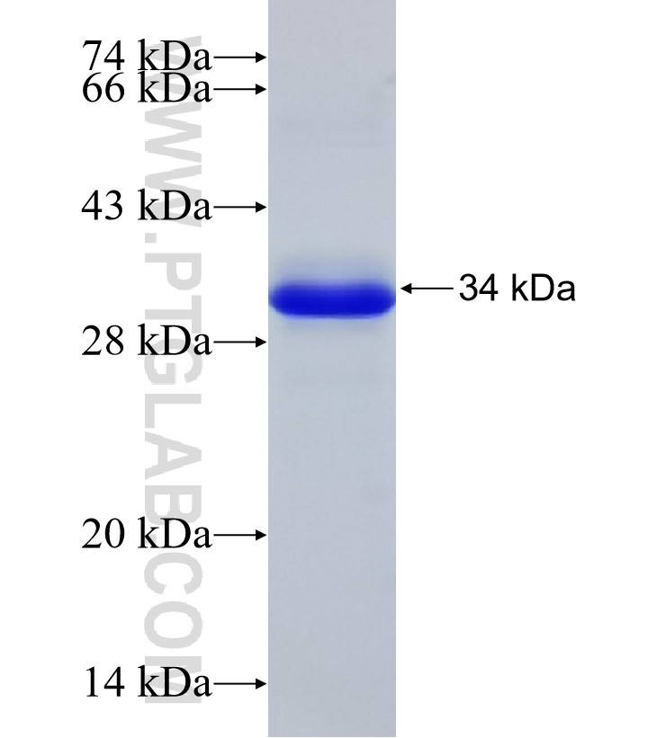 CEP162 fusion protein Ag33113 SDS-PAGE