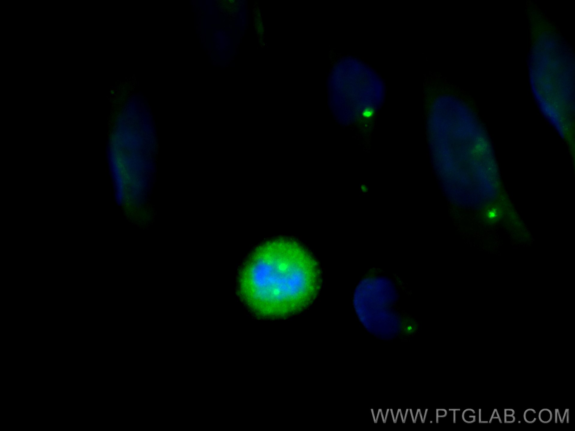 IF Staining of HeLa using 22227-1-AP