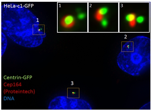 IF Staining of HeLa cells using 22227-1-AP