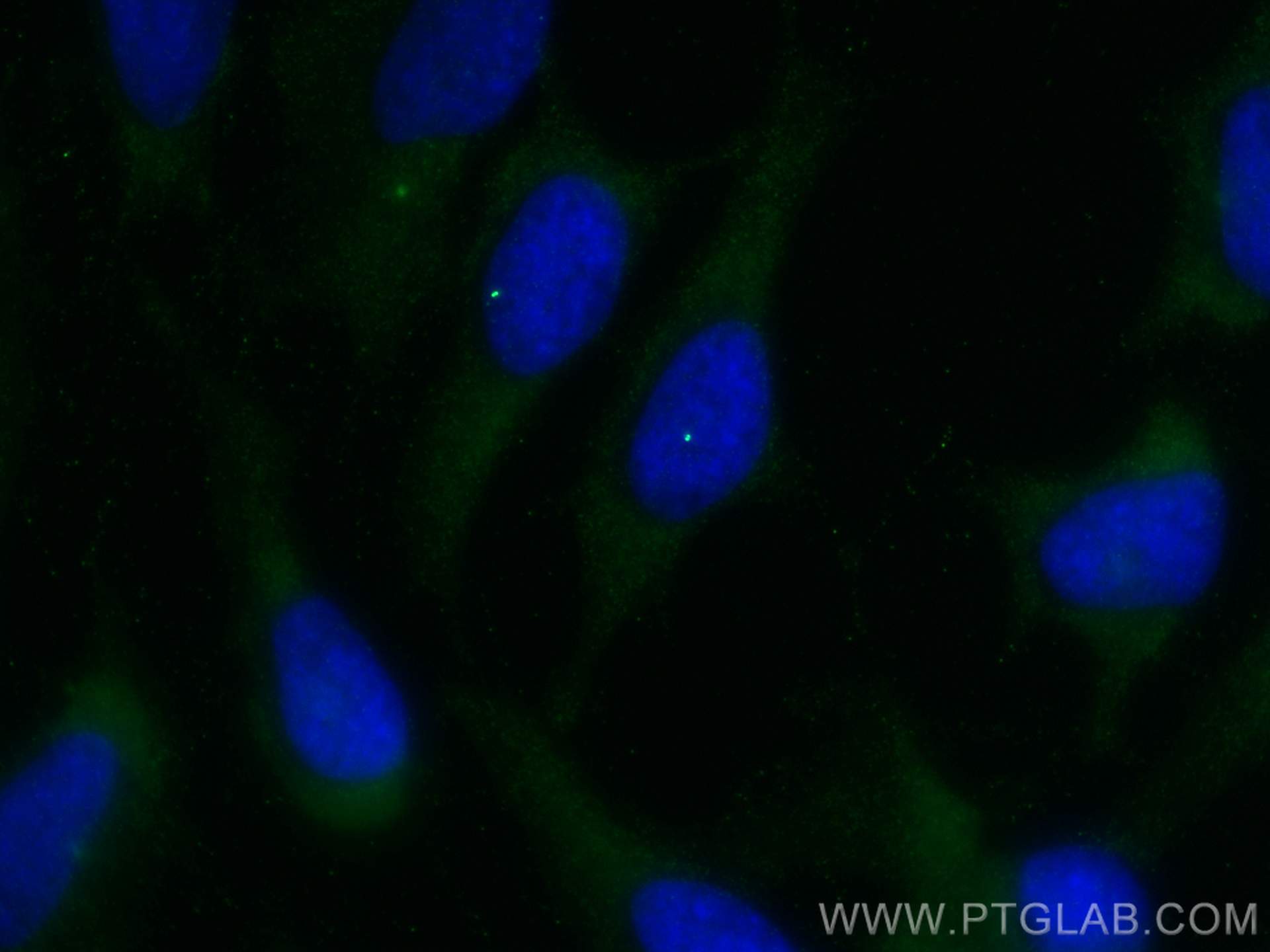 IF Staining of HeLa using 22227-1-AP