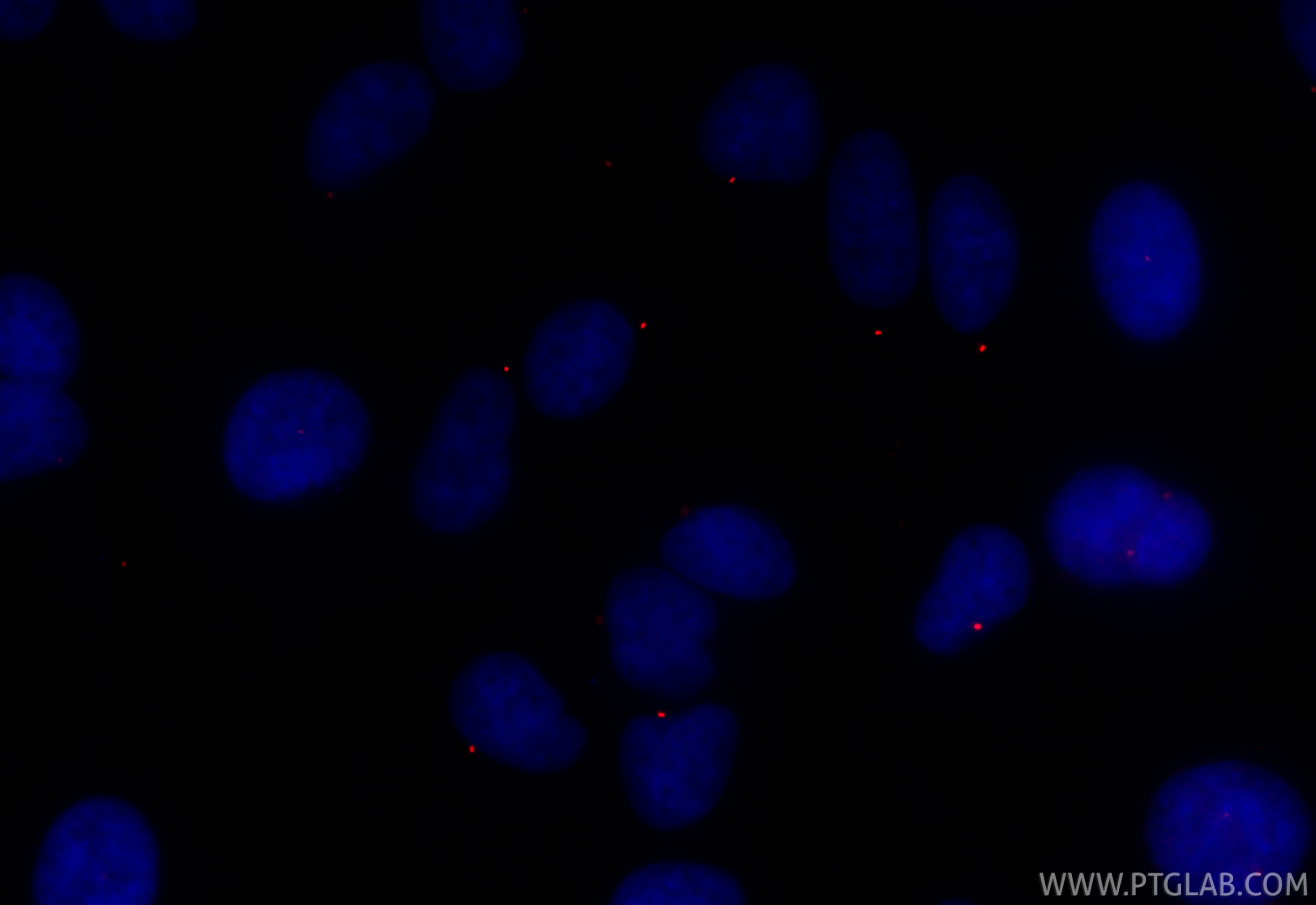 IF Staining of ARPE-19 using CL594-22227 IF Staining of ARPE-19 using CL594-22227