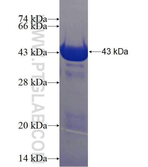 CEP164 fusion protein Ag17570 SDS-PAGE