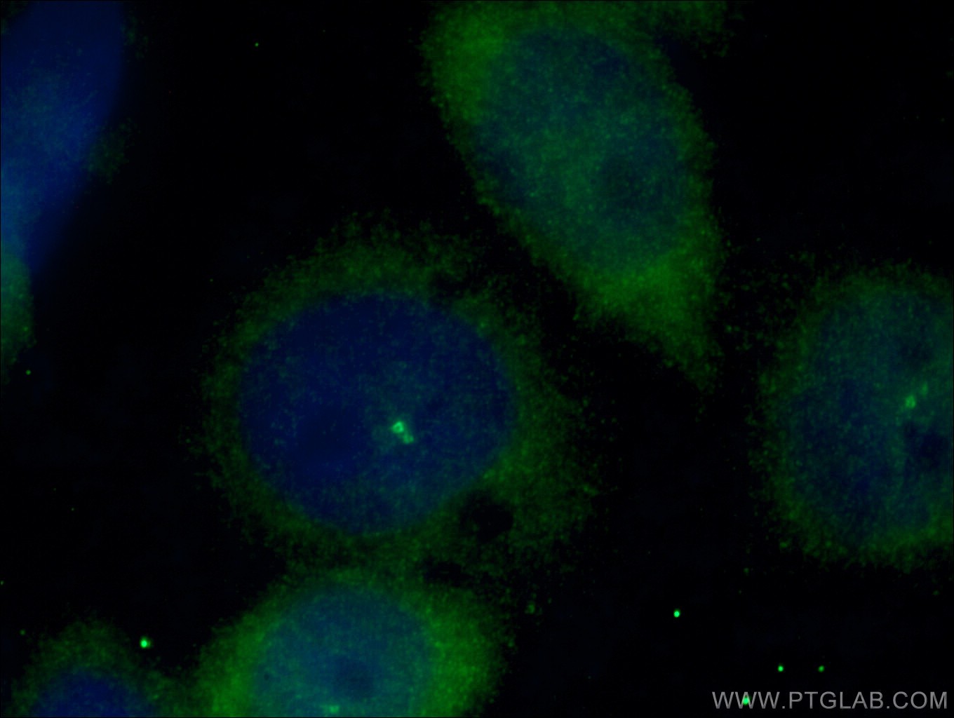 IF Staining of HeLa using 27325-1-AP