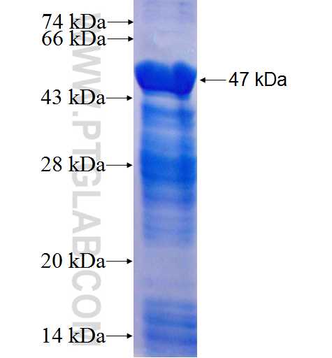 CEP170 fusion protein Ag26311 SDS-PAGE