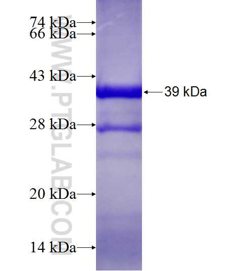 CEP170L fusion protein Ag13575 SDS-PAGE CEP170L fusion protein Ag13575 SDS-PAGE