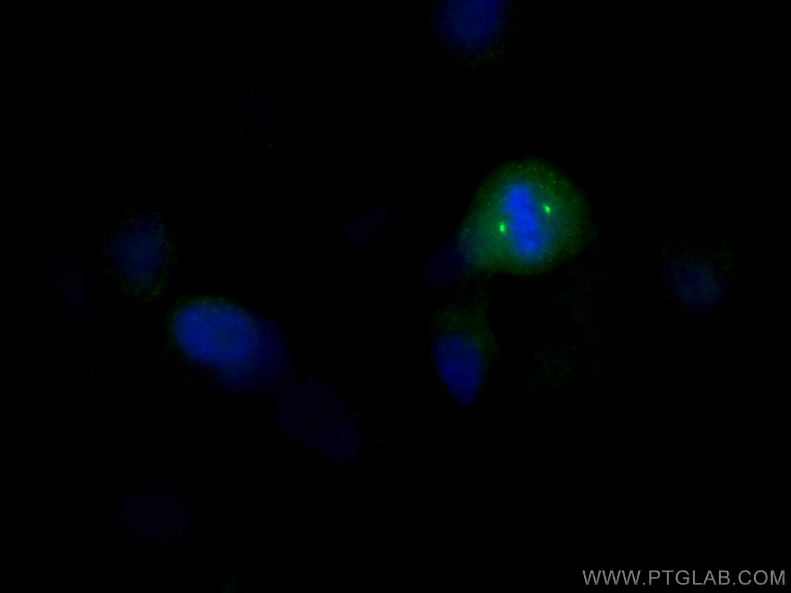 IF Staining of HeLa using 28700-1-AP