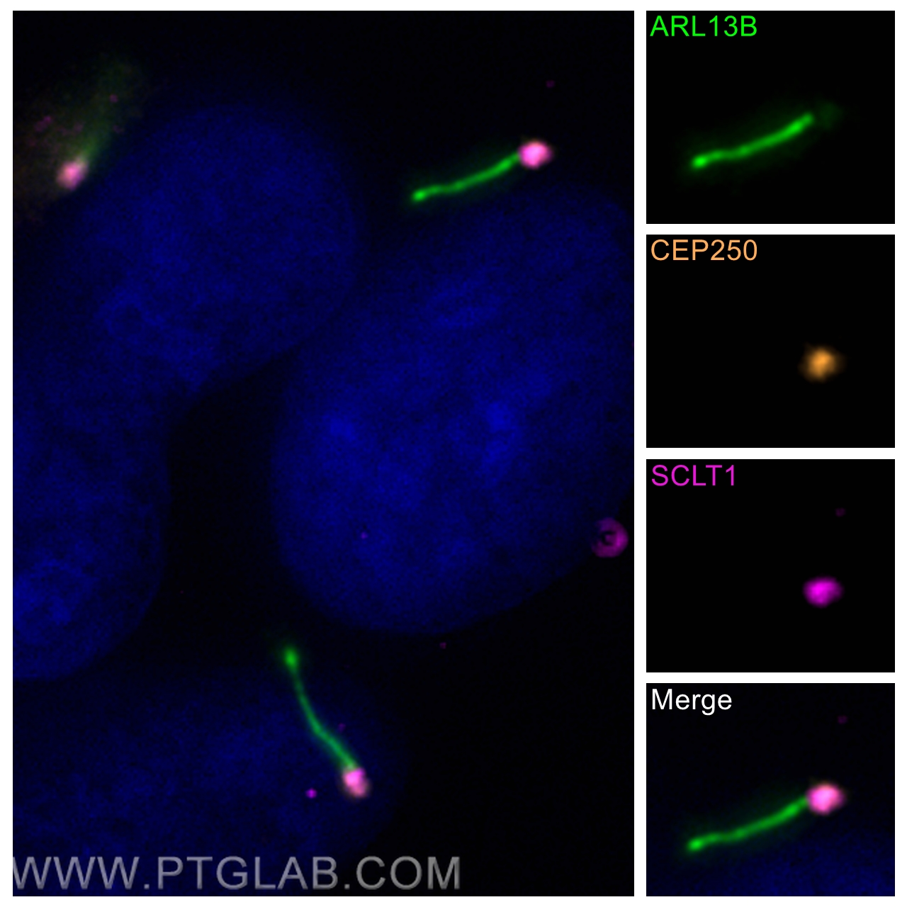 IF Staining of hTERT-RPE1 using 14498-1-AP