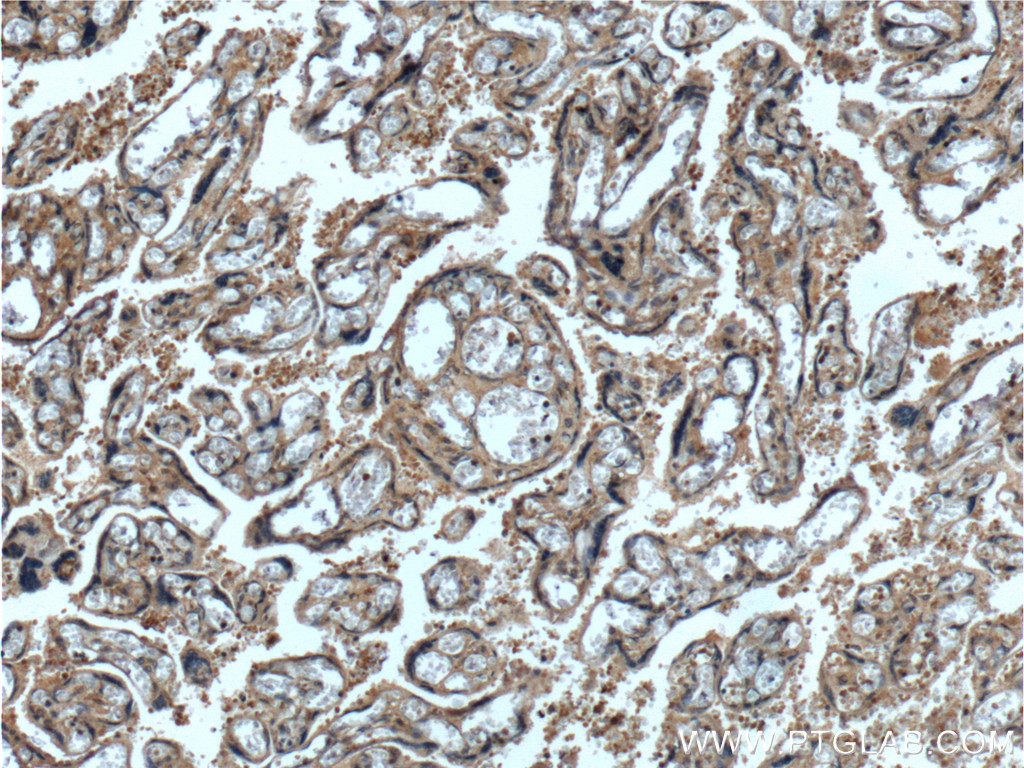 IHC staining of human placenta using 14498-1-AP