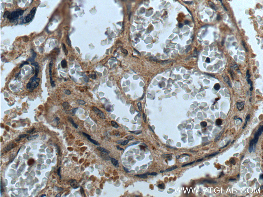 IHC staining of human placenta using 14498-1-AP