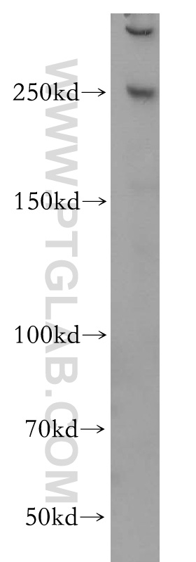 WB analysis of HeLa using 14498-1-AP