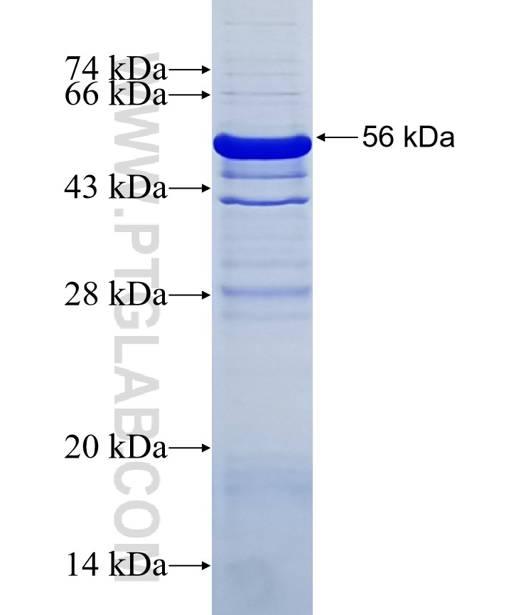 CEP250,C-NAP1 fusion protein Ag0394 SDS-PAGE CEP250,C-NAP1 fusion protein Ag0394 SDS-PAGE