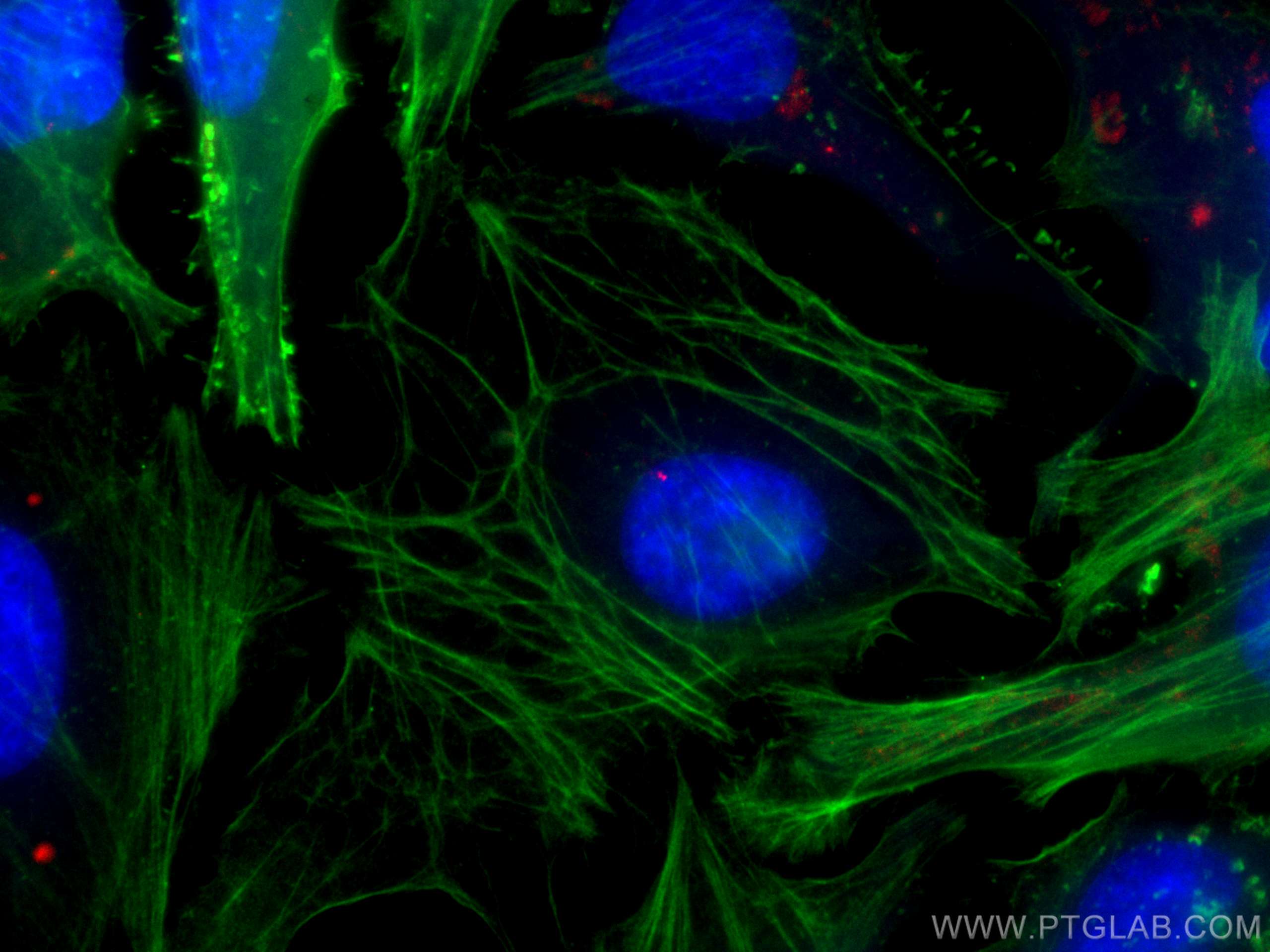 IF Staining of HeLa using CL594-14498