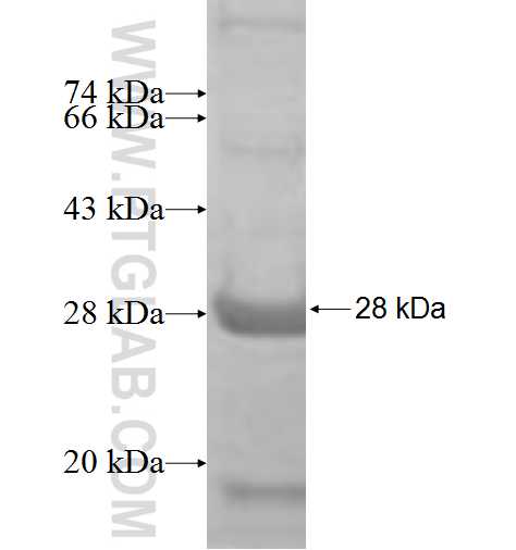 CEP27 fusion protein Ag9195 SDS-PAGE CEP27 fusion protein Ag9195 SDS-PAGE