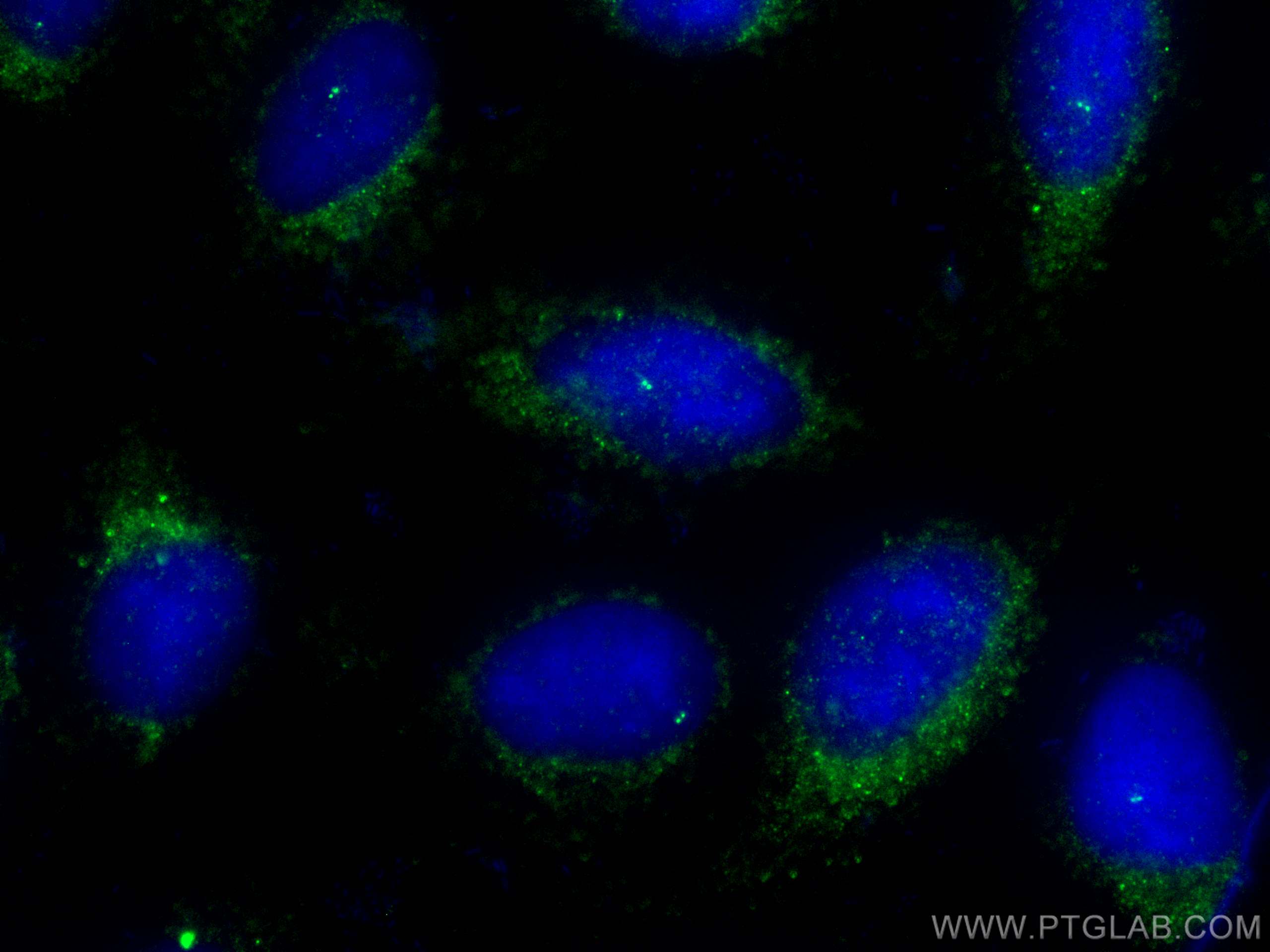 IF Staining of U2OS using 30446-1-AP
