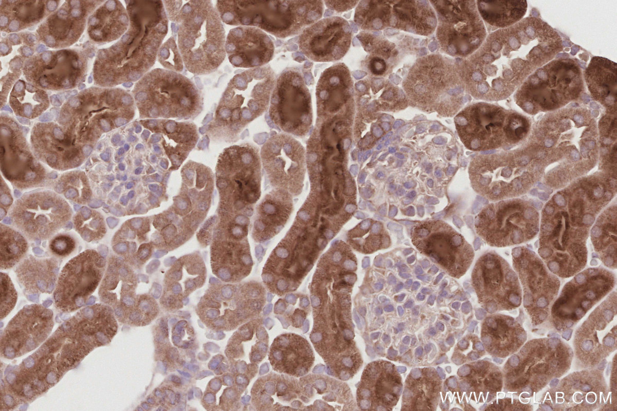 IHC staining of mouse kidney using 30446-1-AP IHC staining of mouse kidney using 30446-1-AP