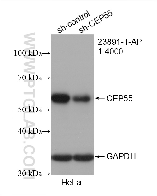 WB analysis of HeLa using 23891-1-AP