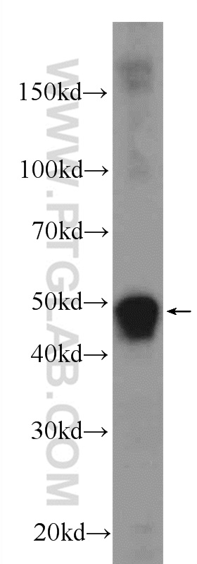 CEP55 Polyclonal antibody