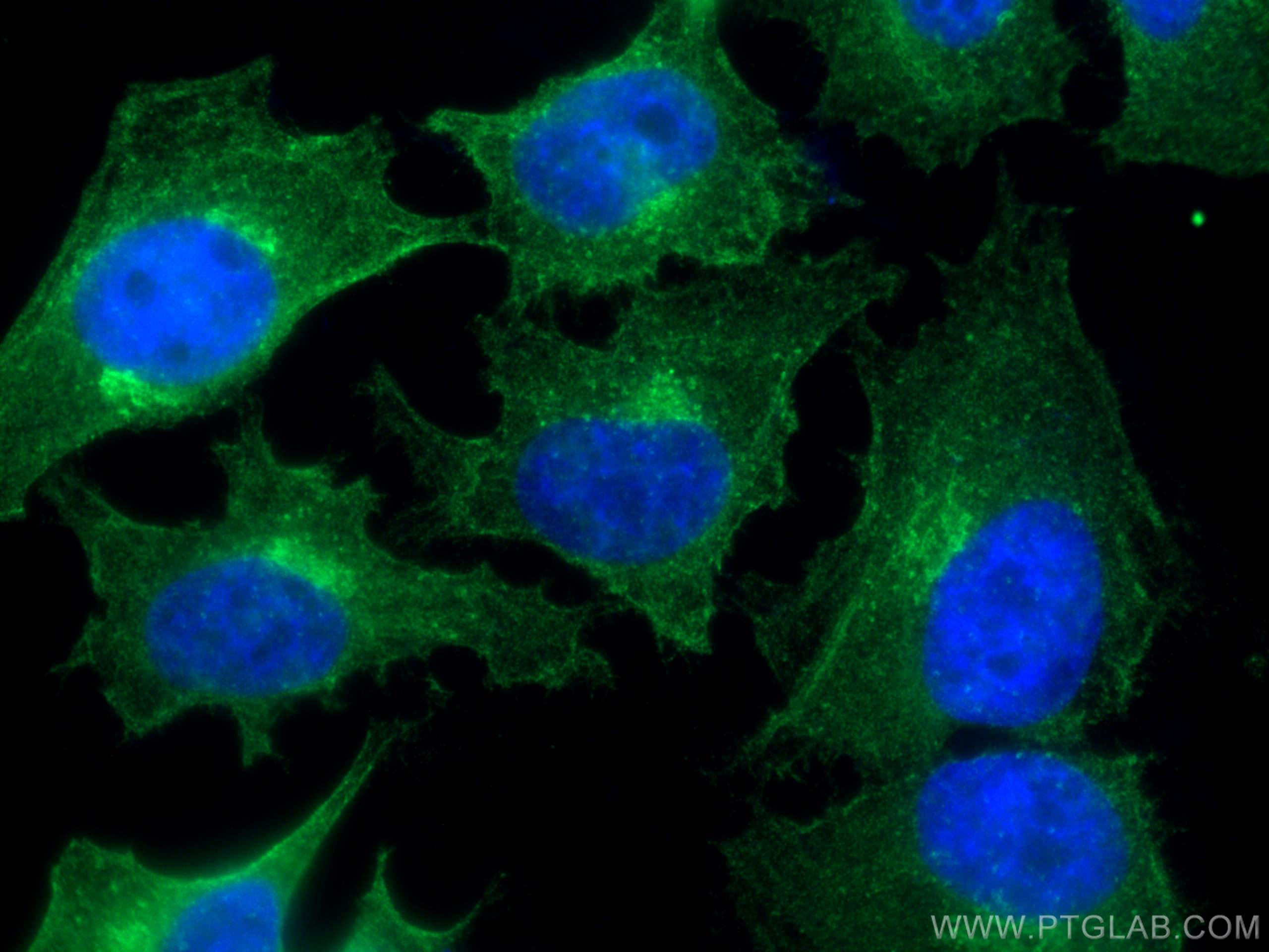 IF Staining of HeLa using 67460-1-Ig (same clone as 67460-1-PBS)