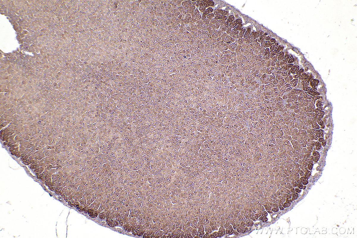 IHC staining of mouse adrenal gland using 67460-1-Ig (same clone as 67460-1-PBS)
