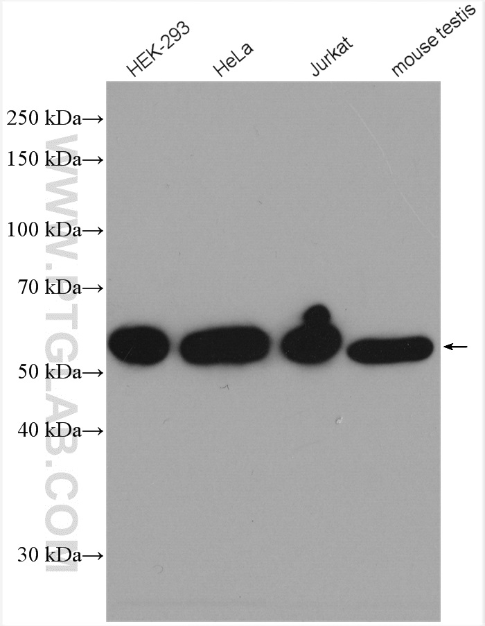 WB analysis using 67460-1-Ig