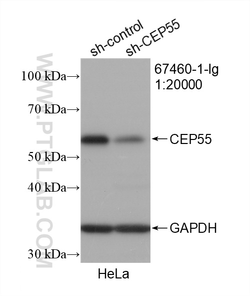 WB analysis of HeLa using 67460-1-Ig (same clone as 67460-1-PBS)