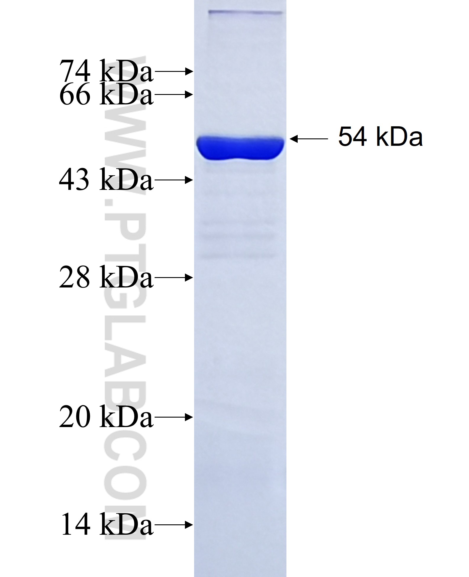 CEP55 fusion protein Ag20940 SDS-PAGE