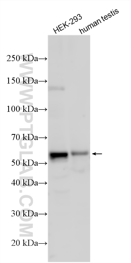 Various lysates were subjected to SDS PAGE followed by western blot with 27031-1-AP (CEP57 antibody) at dilution of 1:1000 incubated at room temperature for 1.5 hours. WB analysis using 27031-1-AP