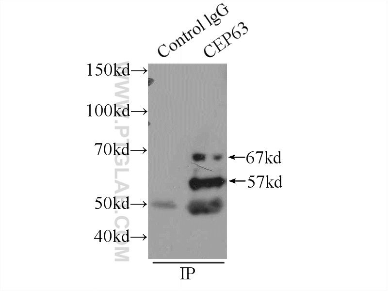 IP experiment of HEK-293 using 16268-1-AP