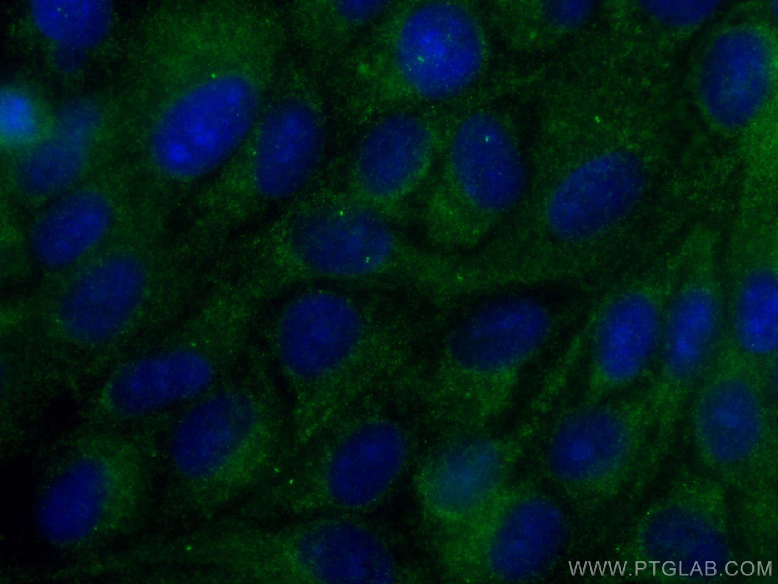 IF Staining of hTERT-RPE1 using CL488-66996