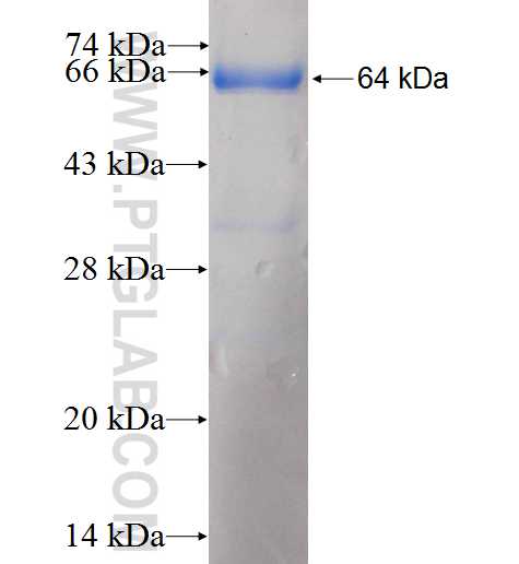 CEP63 fusion protein Ag9335 SDS-PAGE