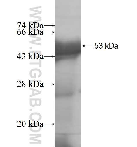 CEP68 fusion protein Ag7471 SDS-PAGE CEP68 fusion protein Ag7471 SDS-PAGE