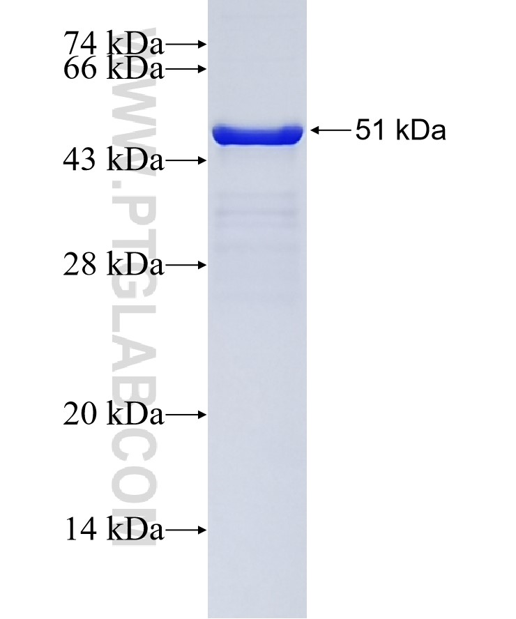 CEP70 fusion protein Ag9365 SDS-PAGE