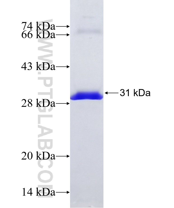 CEP70 fusion protein Ag9515 SDS-PAGE