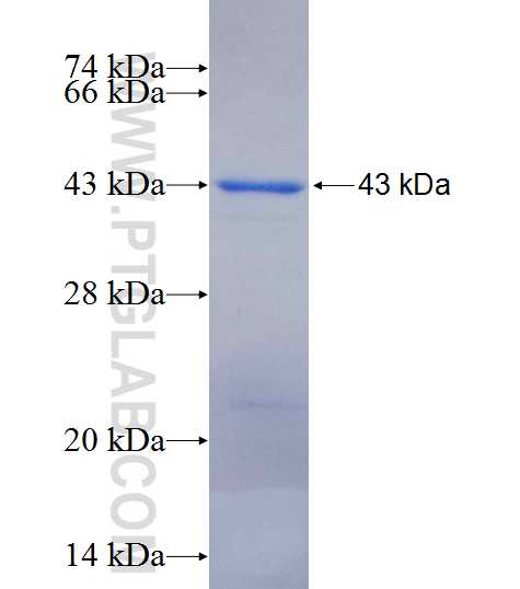 CEP72 fusion protein Ag13954 SDS-PAGE CEP72 fusion protein Ag13954 SDS-PAGE