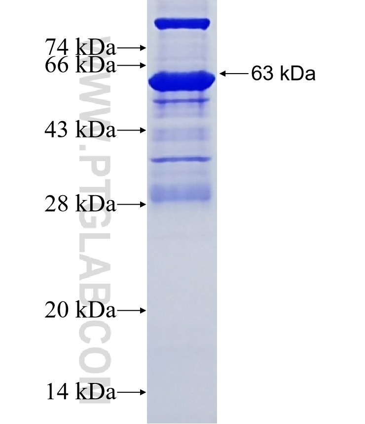 CEP76 fusion protein Ag10572 SDS-PAGE CEP76 fusion protein Ag10572 SDS-PAGE
