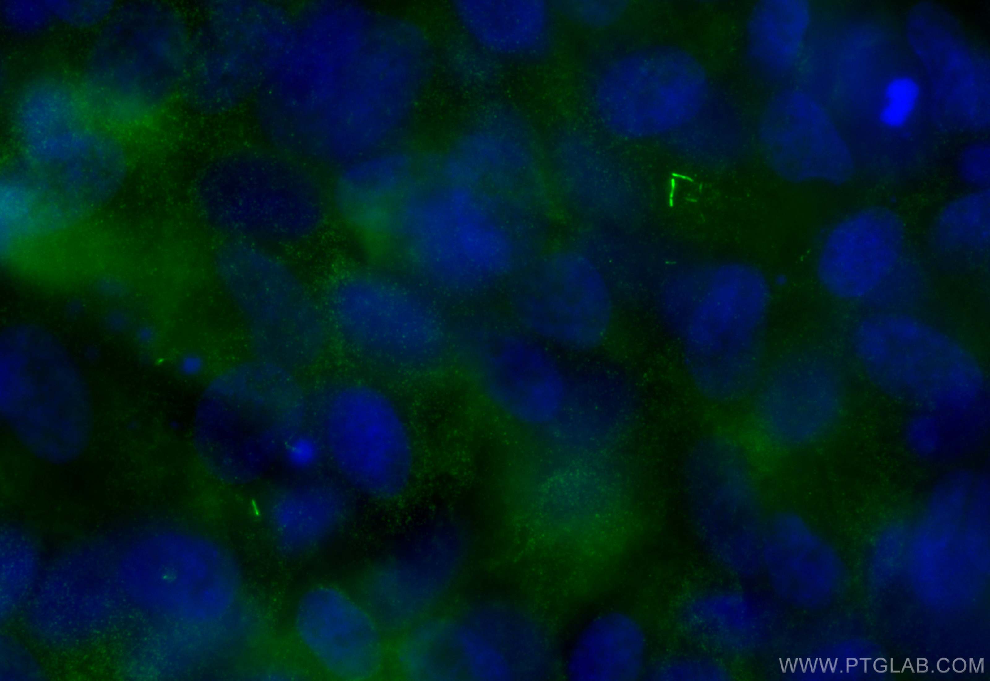 IF Staining of hTERT-RPE1 using 30165-1-AP (same clone as 30165-1-PBS)