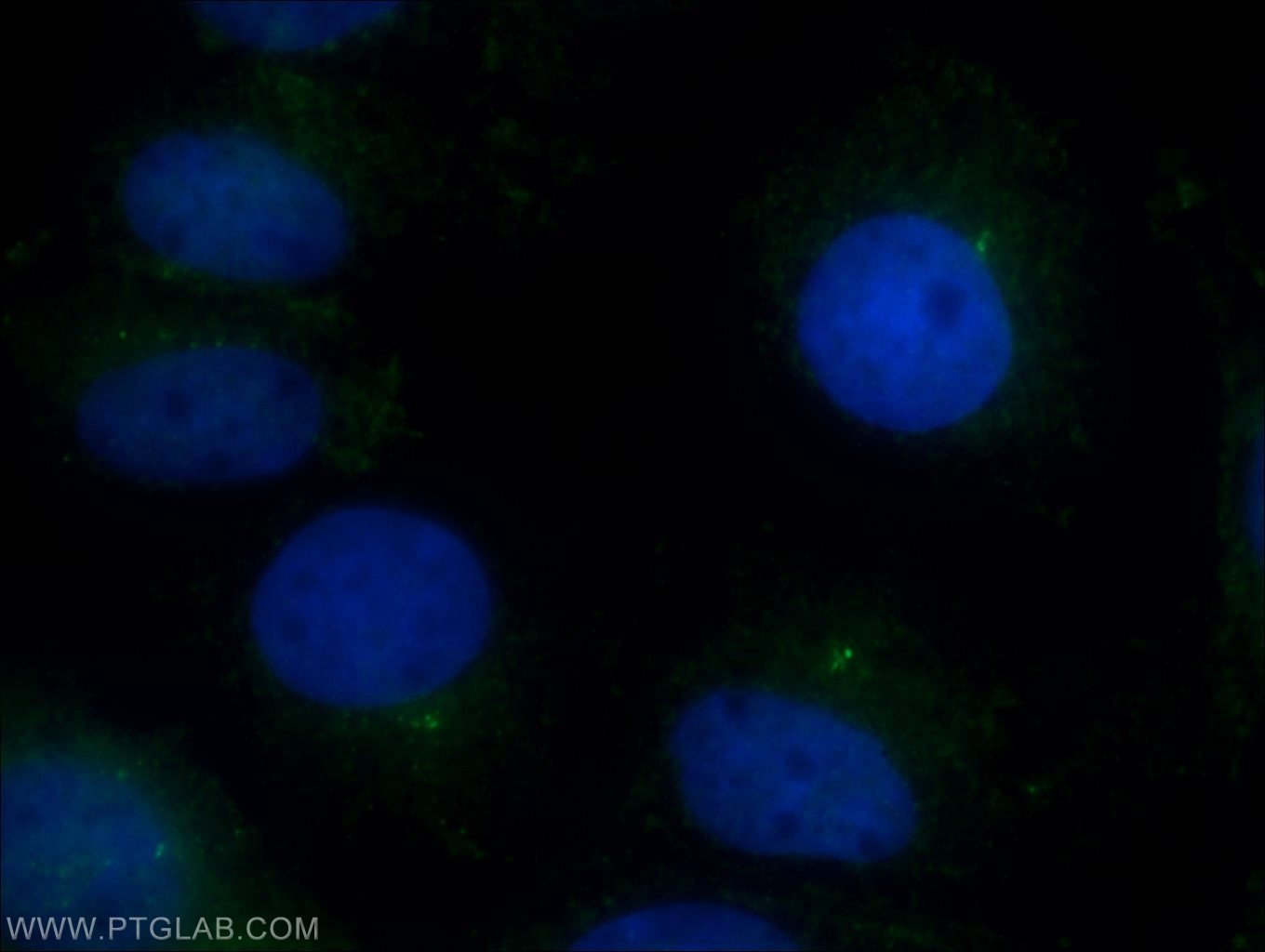 IF Staining of MDCK using 22050-1-AP
