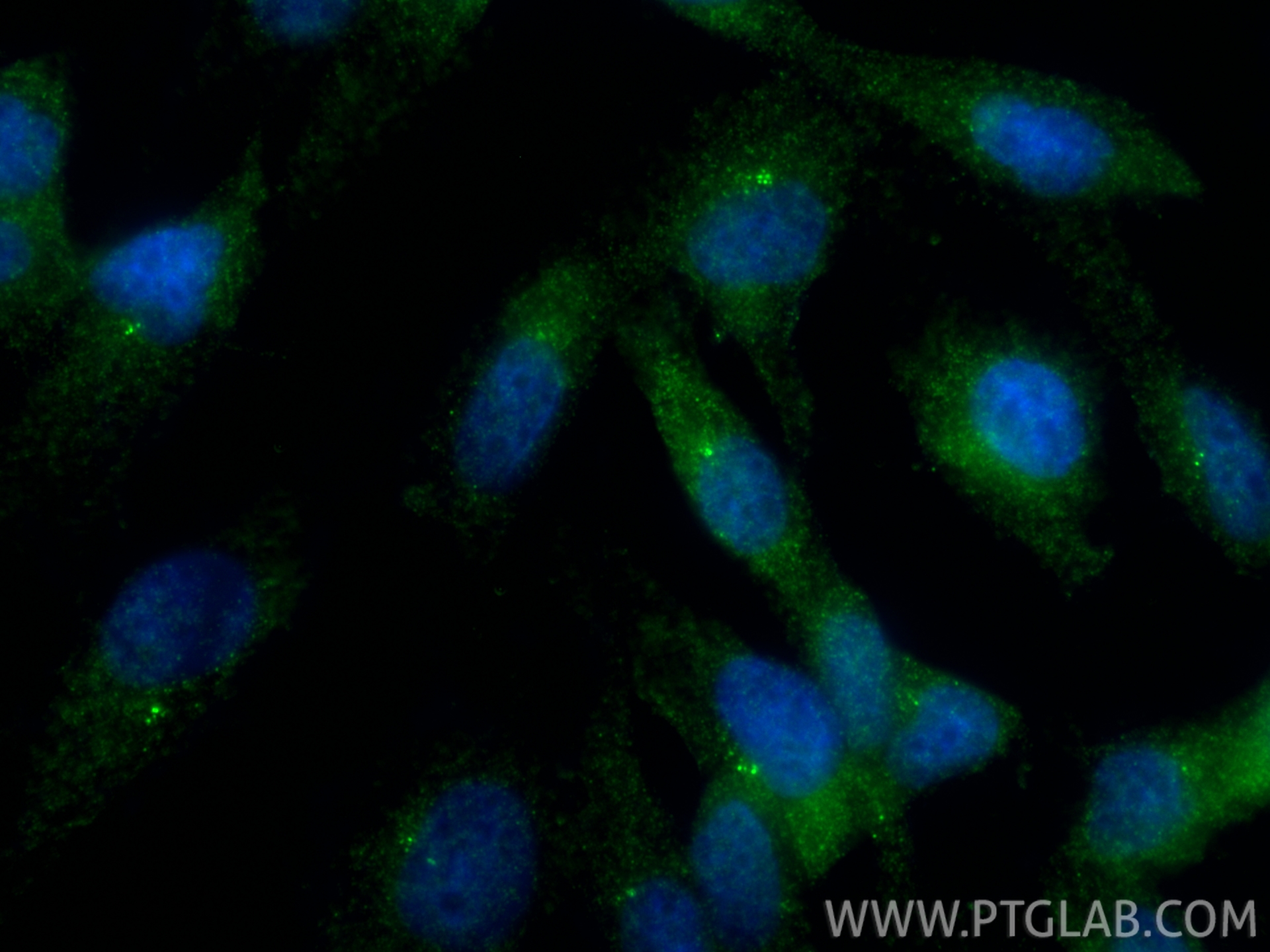 Immunofluorescent analysis of (4% PFA) fixed MDCK cells using CEP97 antibody (22050-1-AP) at dilution of 1:1000 and CoraLite®488-Conjugated Goat Anti-Rabbit IgG(H+L) (<a class='green' href='/productredirect?CatalogNo=SA00013-2' target='_blank'>SA00013-2</a>). IF Staining of MDCK using 22050-1-AP