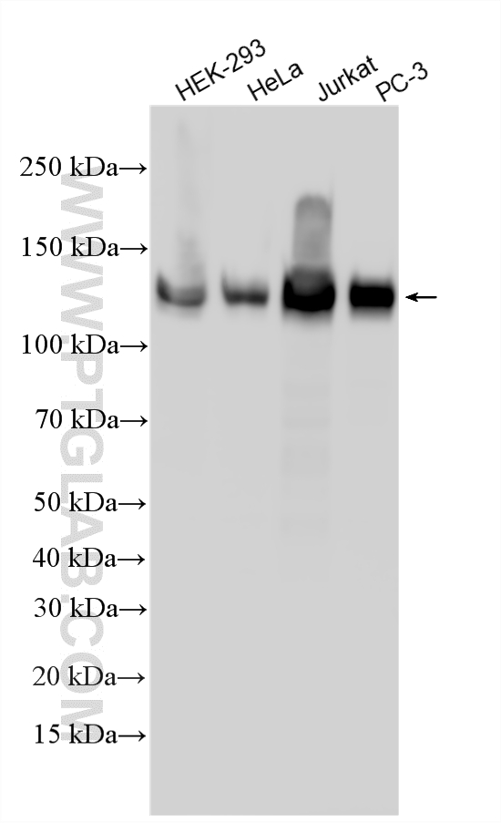 WB analysis using 22050-1-AP (same clone as 22050-1-PBS) WB analysis using 22050-1-AP (same clone as 22050-1-PBS)
