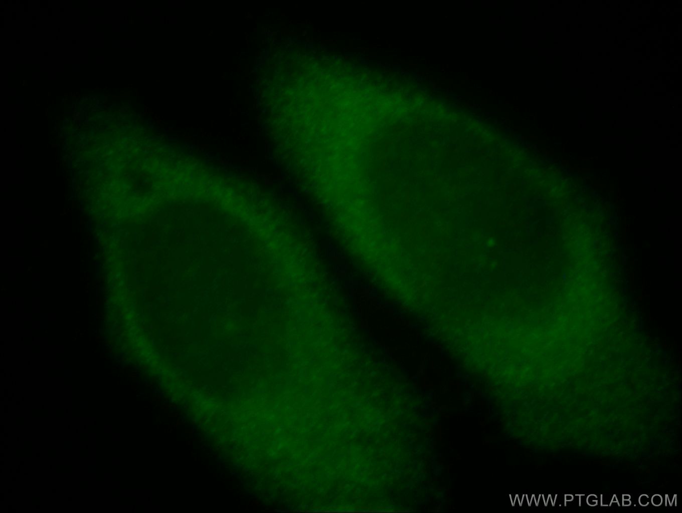 IF Staining of HepG2 using 20496-1-AP