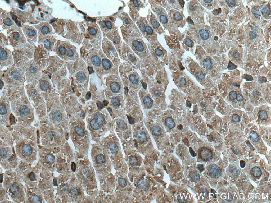 Immunohistochemical analysis of paraffin-embedded mouse liver tissue slide using 20496-1-AP (CEPT1 antibody) at dilution of 1:200 (under 40x lens). Heat mediated antigen retrieval with Tris-EDTA buffer (pH 9.0). IHC staining of mouse liver using 20496-1-AP