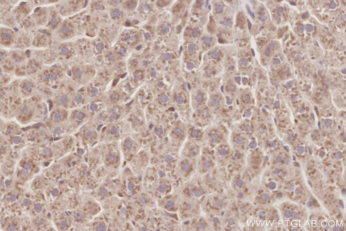 Immunohistochemical analysis of paraffin-embedded rat liver tissue slide using 20496-1-AP (CEPT1 antibody) at dilution of 1:1000 (under 40x lens). Heat mediated antigen retrieval with Tris-EDTA buffer (pH 9.0). IHC staining of rat liver using 20496-1-AP