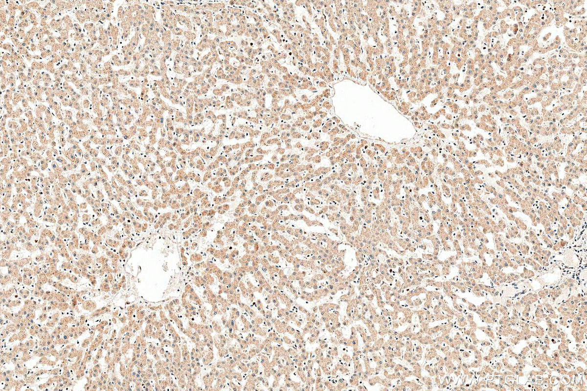 IHC staining of human liver using 20496-1-AP IHC staining of human liver using 20496-1-AP