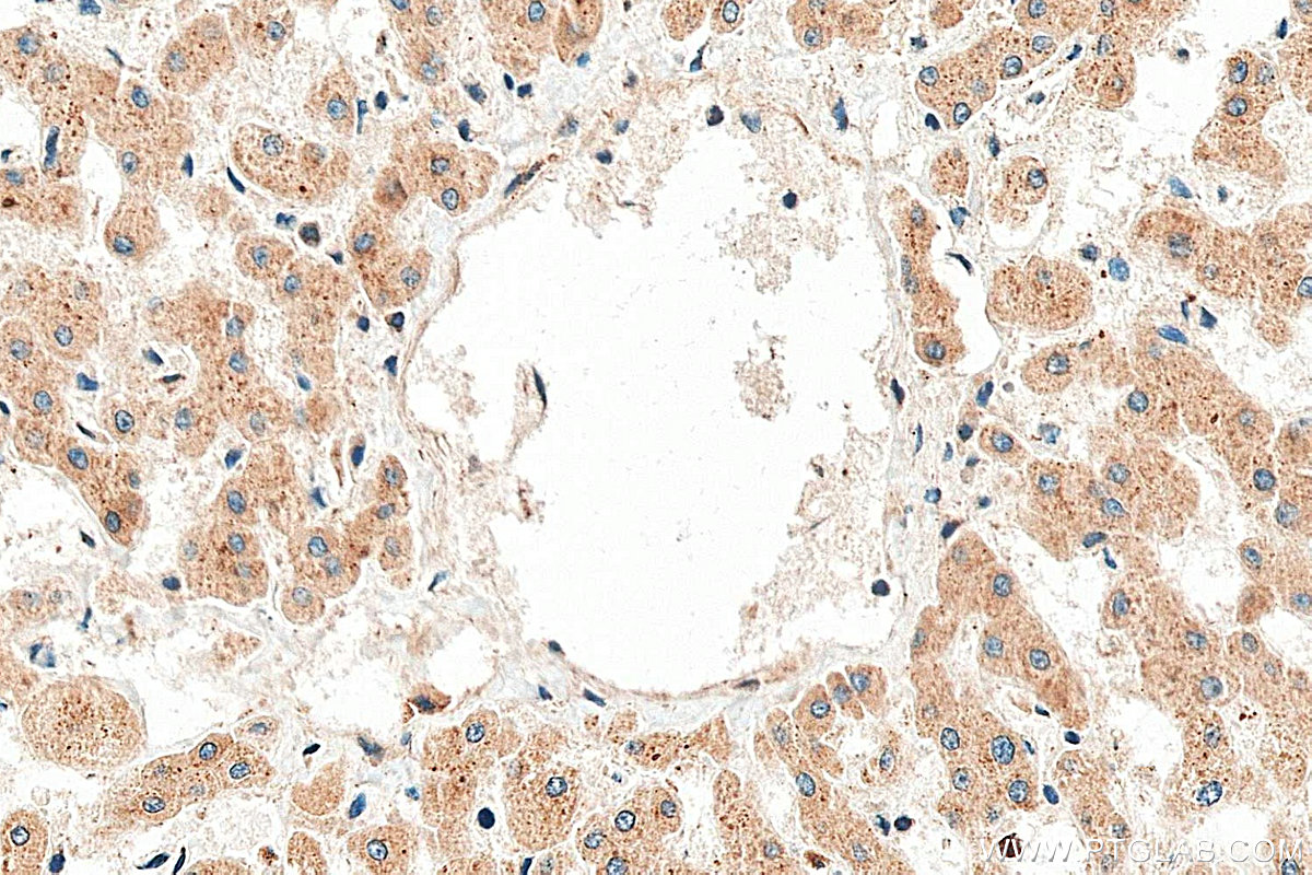 IHC staining of human liver using 20496-1-AP IHC staining of human liver using 20496-1-AP