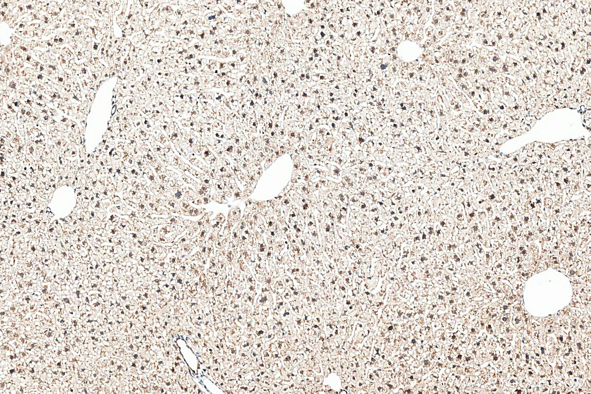 IHC staining of mouse liver using 20496-1-AP IHC staining of mouse liver using 20496-1-AP