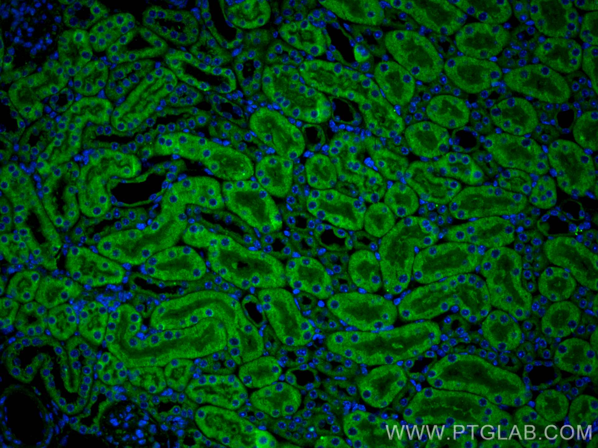 IF Staining of mouse kidney using 18879-1-AP
