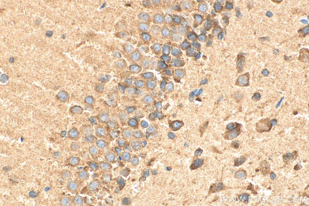 IHC staining of rat brain using 16411-1-AP