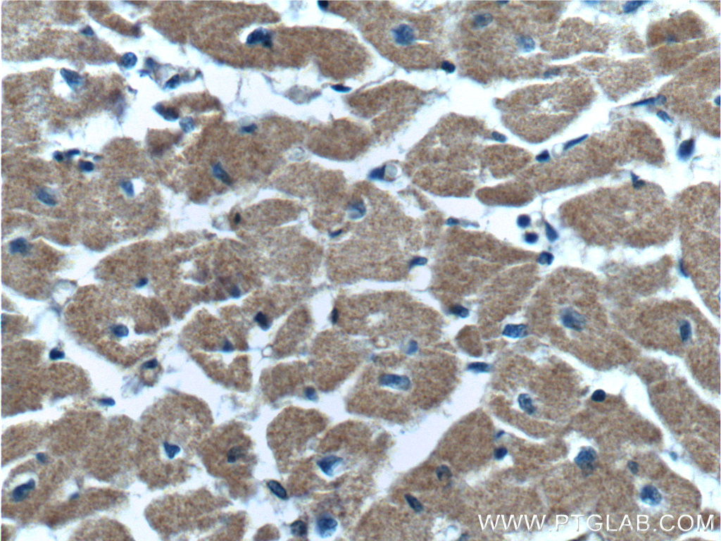 IHC staining of human heart using 10467-1-AP
