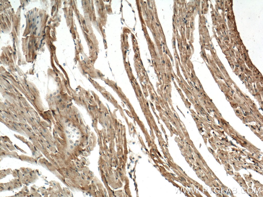 IHC staining of mouse heart using 25731-1-AP