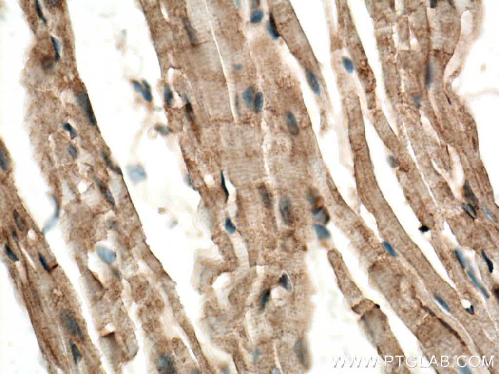 IHC staining of mouse heart using 25731-1-AP